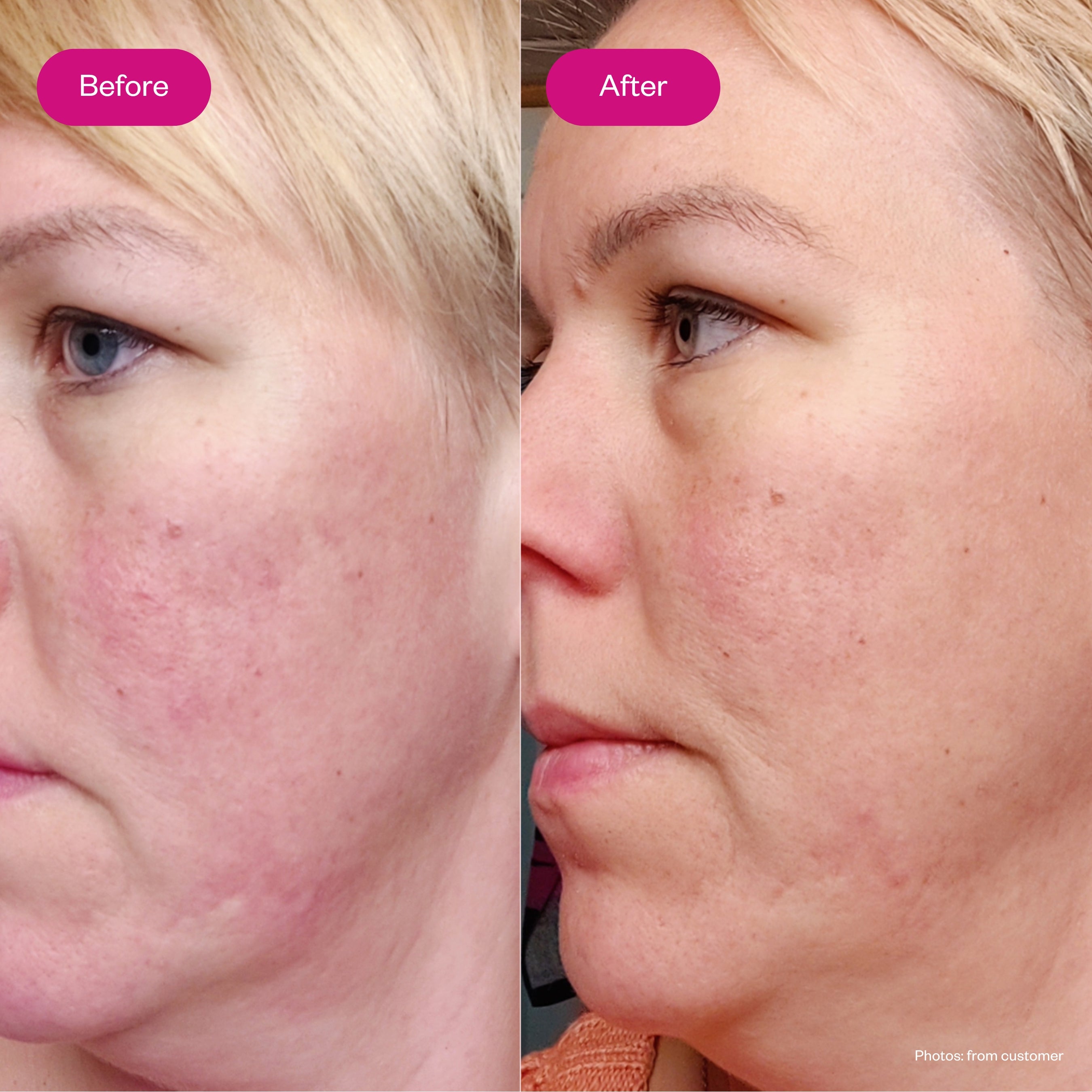 AHA & BHA Peeling Night Serum