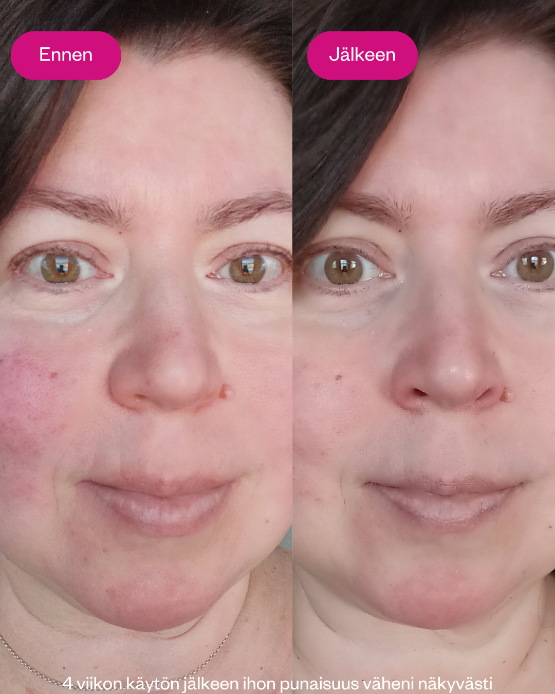 Arctic Beauty Cream kasvovoide kuivalle iholle