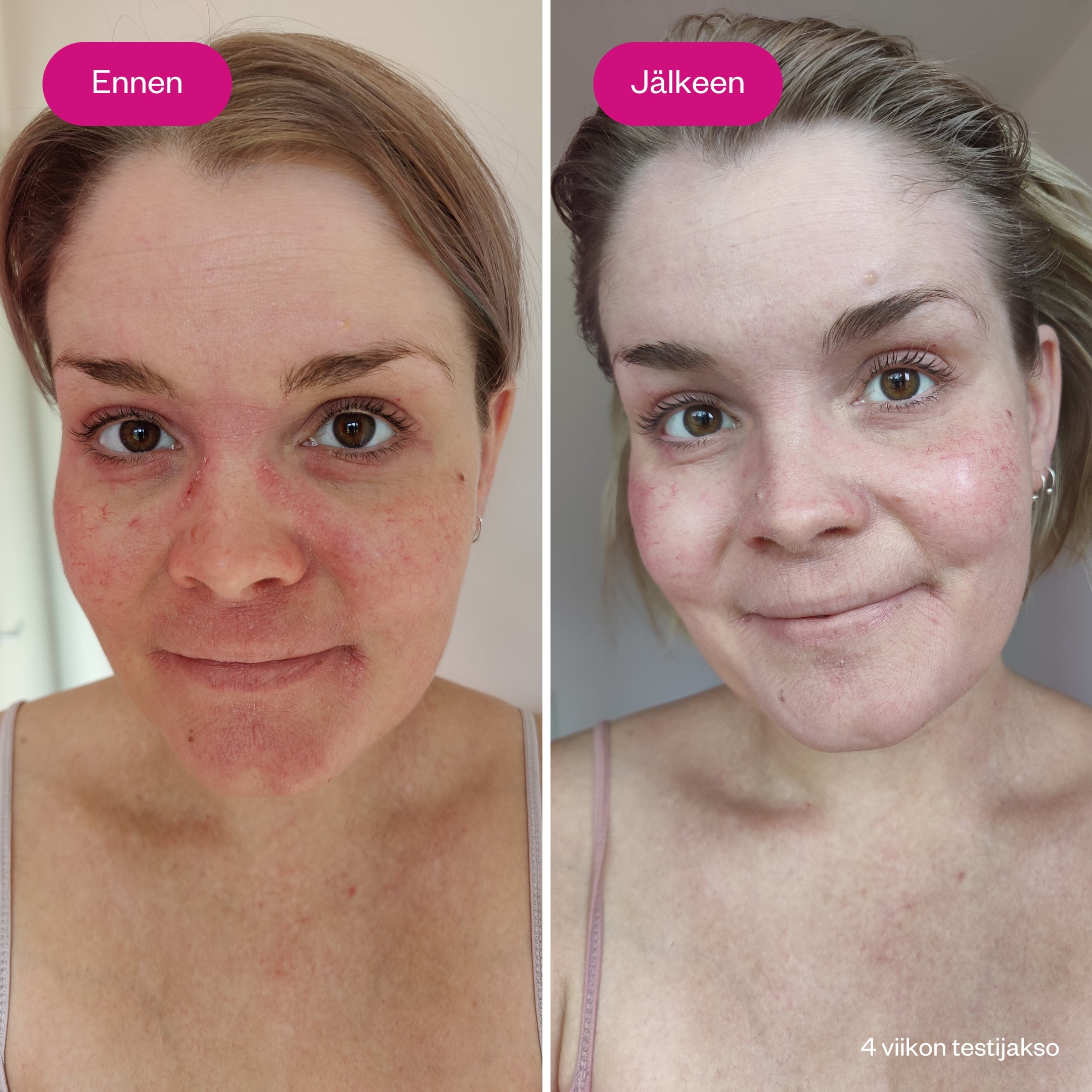 Ceramides & Probiotics herkän ihon hajusteeton ja korjaava kasvovoide