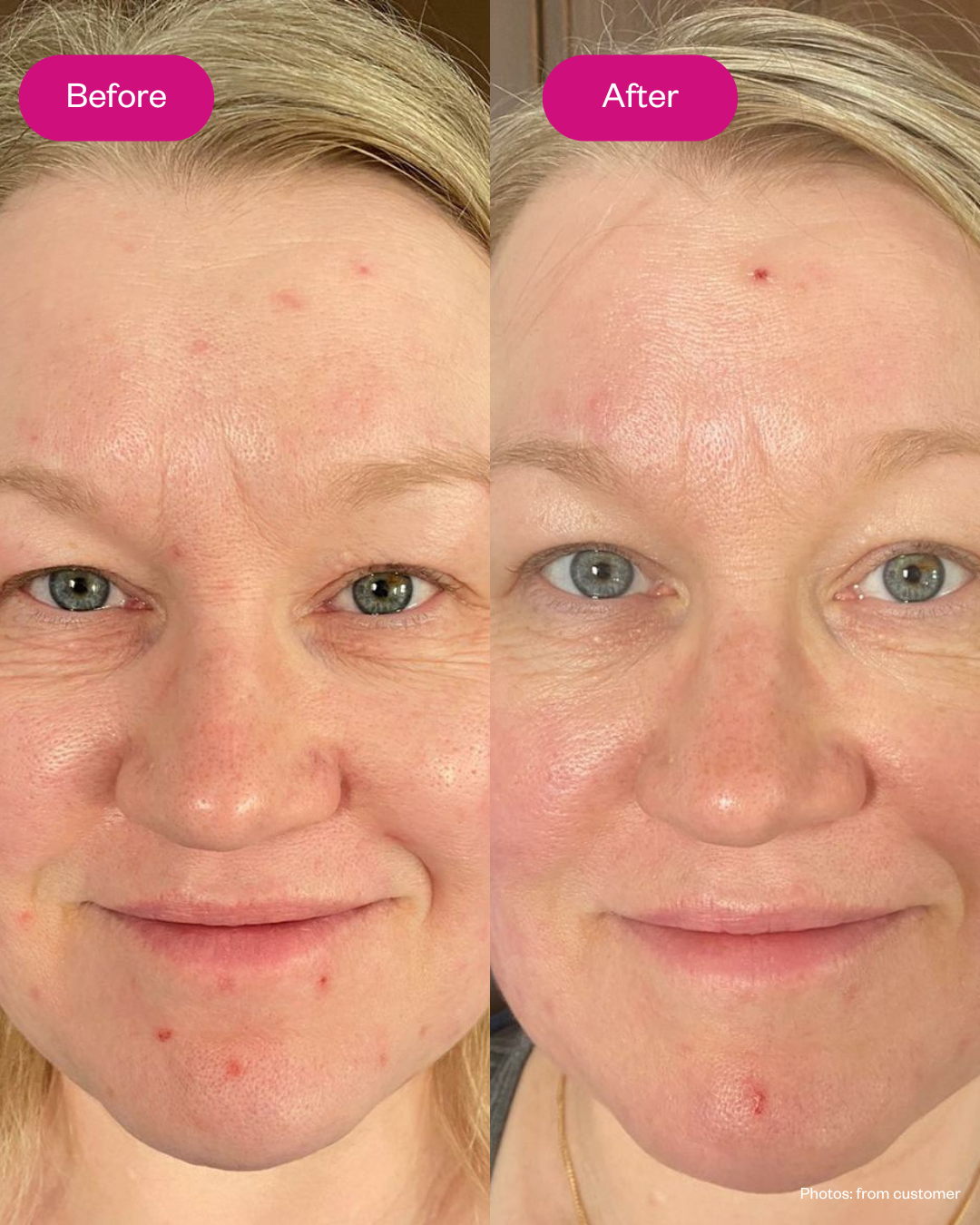 Retin 3-in-1 Cream for Aging Skin