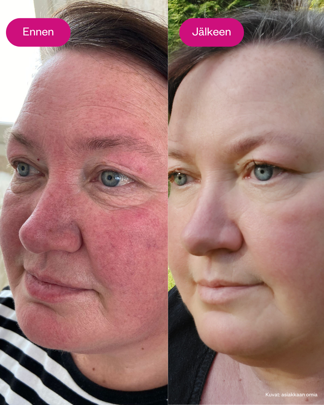 Retin Lift 3-in1 Cream kasvovoide ikääntyvälle iholle