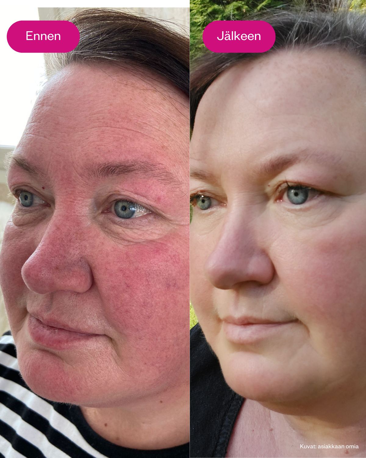 Retin Lift 3-in-1 Cream kasvovoide ikääntyvälle iholle
