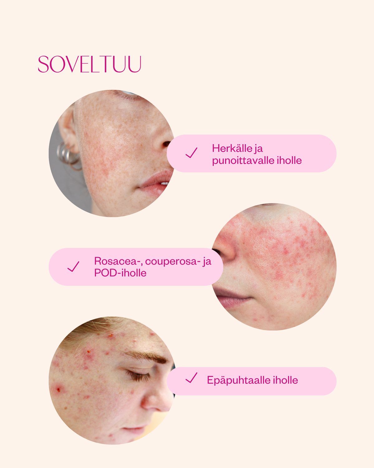 Rosehip Intensive Treatment Oil hoitoöljy herkälle ja haasteelliselle iholle