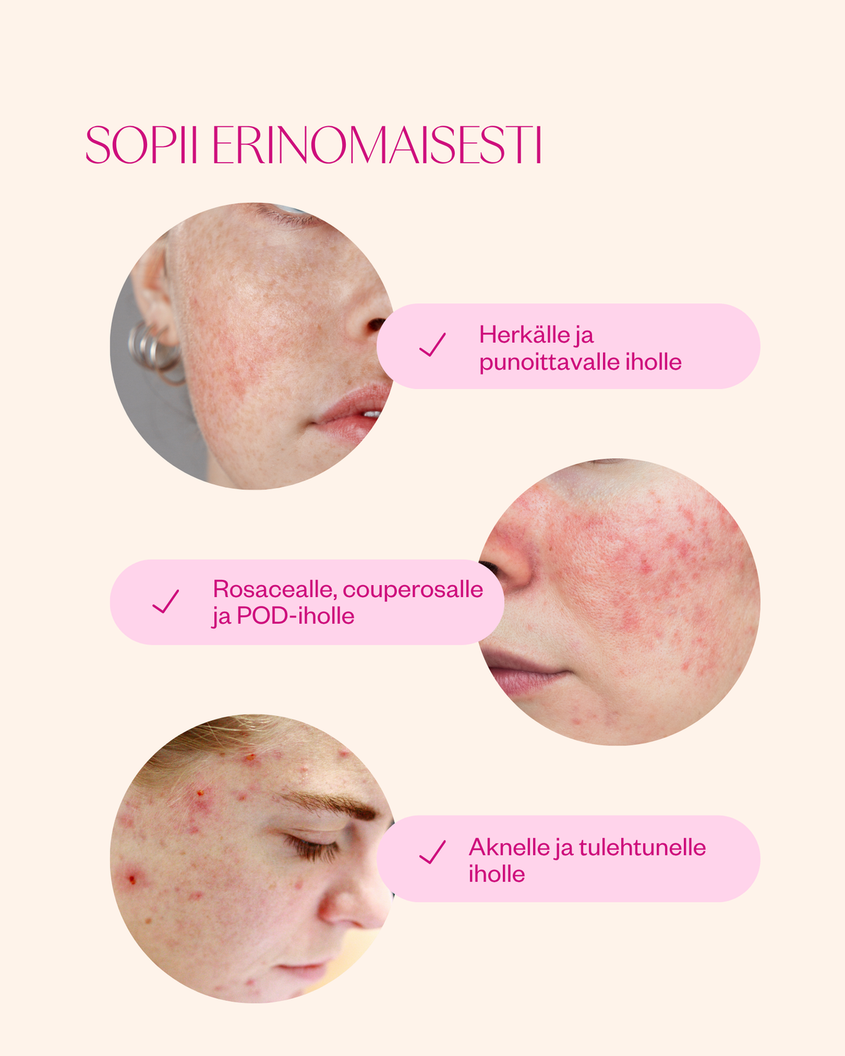 Rosehip Intensive Treatment Oil hoitoöljy herkälle ja haasteelliselle iholle