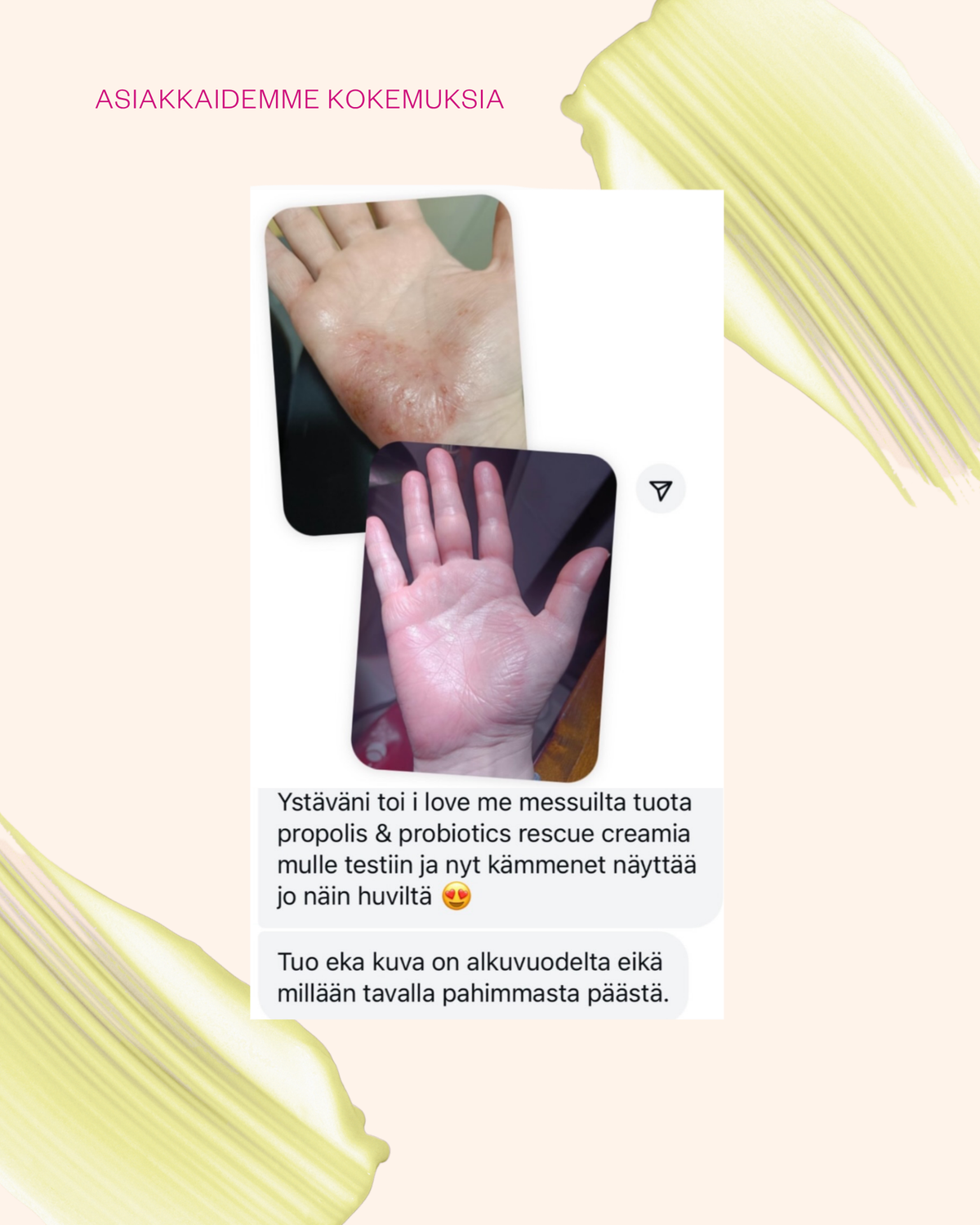 Propolis & Probiotics Rescue Cream erikoisvoide ongelmaiholle