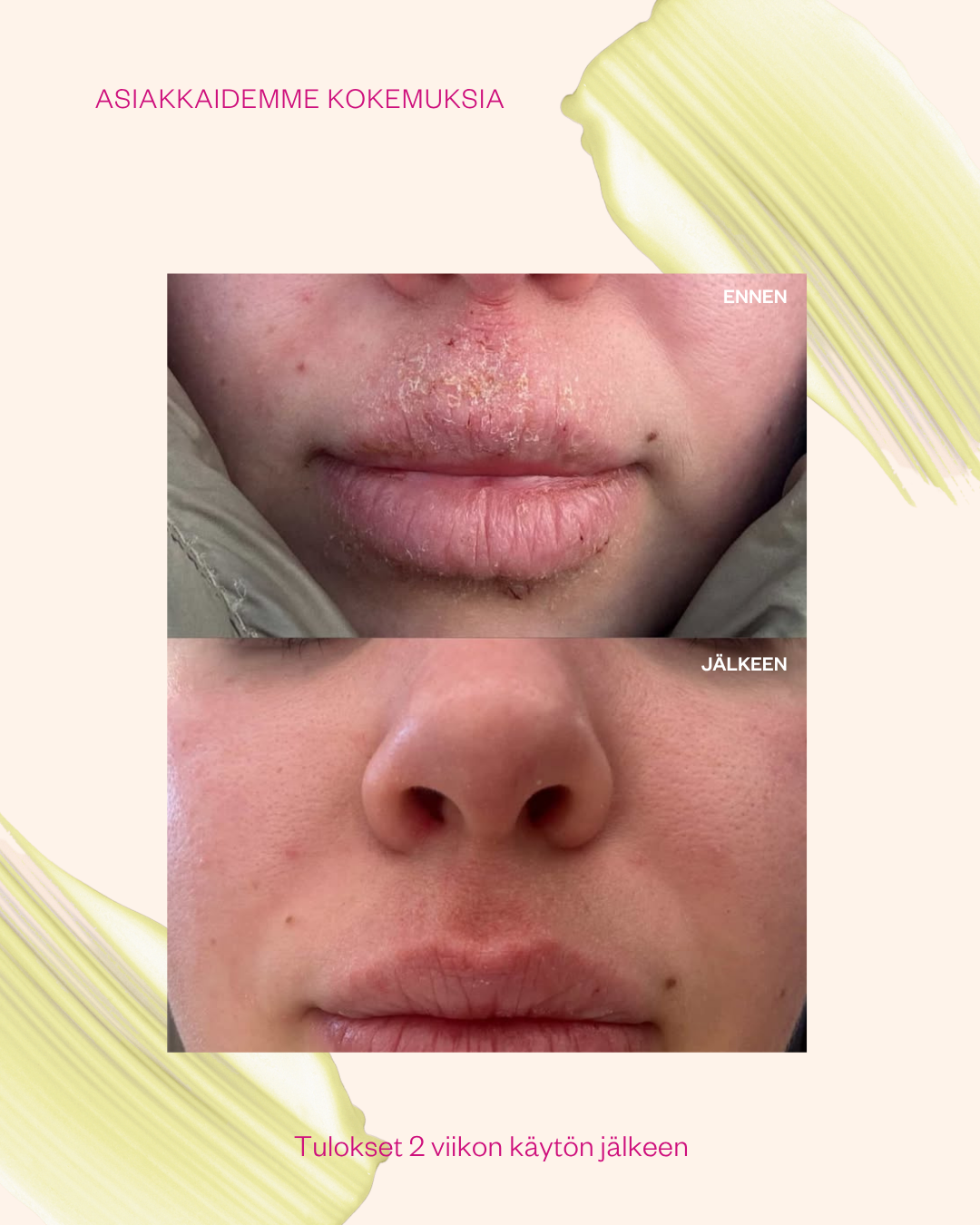 Propolis & Probiotics Rescue Cream matkakoko